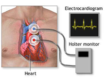 holter_ekg